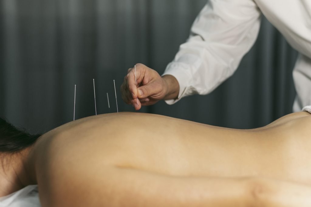 Acupuncturist in Alkmaar