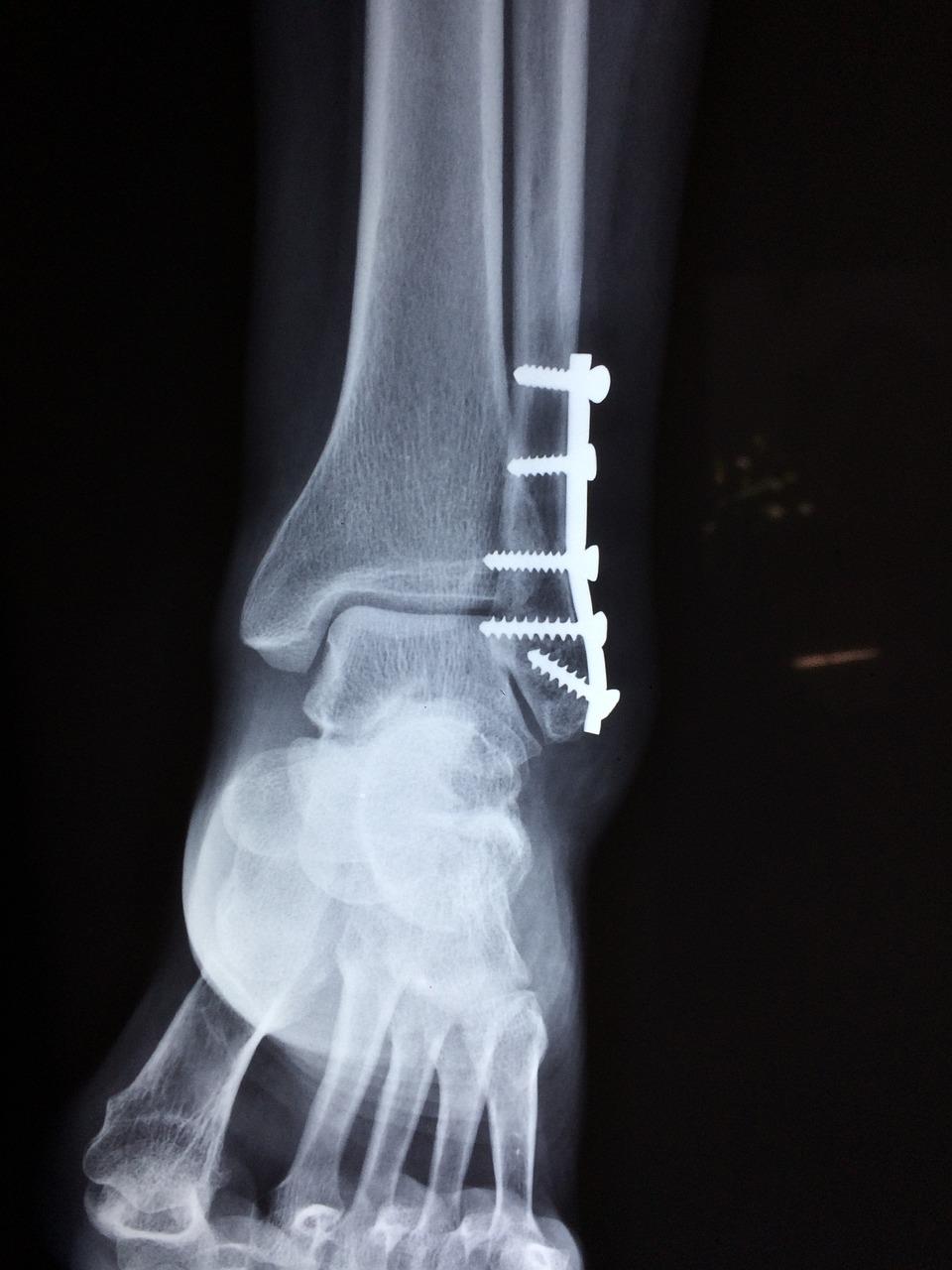 Orthopedie in Alkmaar